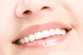 超薄瓷贴片——牙齿美白的秘密武器